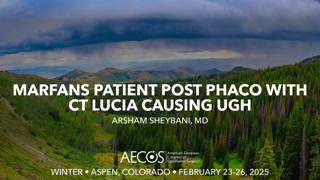 Marfans patient post phaco with CT Lucia causing ugh